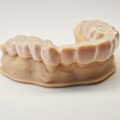 Nakładka relaksacyjna