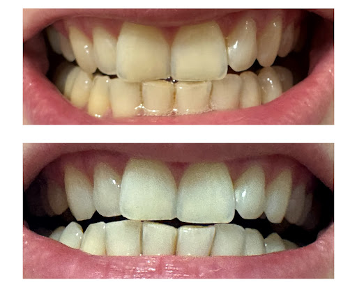 Photo from customer review